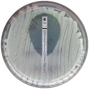 Etest for antimicrobial susceptibility