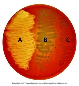 Blood agar plate showing alpha, beta, and gamma hemolysis