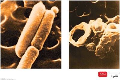SEM of complement-mediated lysis of bacteria