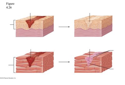 Stages of tissue repair following inflammation