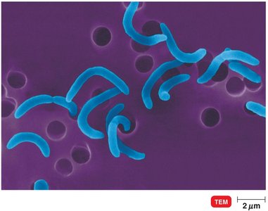 Vibrio cells under TEM