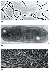 Lactobacillus cells in chains