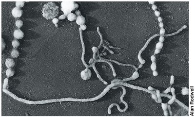 Pleomorphic Mycoplasma cells