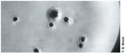 Fried-egg appearance of Mycoplasma colonies