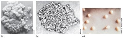 Wrinkled colonies of Mycobacterium
