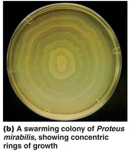 Swarming colony of Proteus mirabilis showing concentric rings