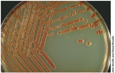 Pigmented colonies of Serratia on agar plate