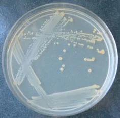 Petri dish with bacterial colonies