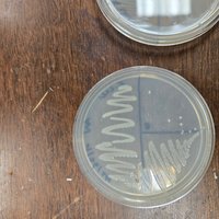 E. coli colonies on nutrient agar