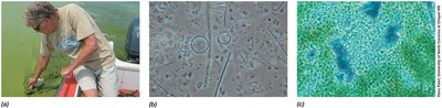 Sampling and microscopy of microbial diversity in aquatic environments