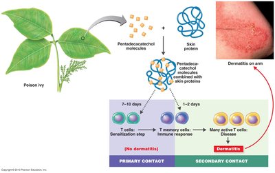 Mechanism of poison ivy-induced contact dermatitis