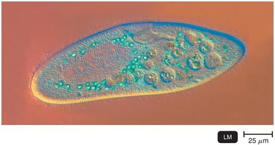 DIC microscopy micrograph