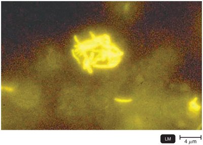 Fluorescence microscopy micrograph