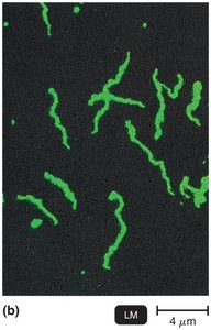 Immunofluorescence principle and micrograph