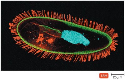 Super-resolution microscopy micrograph