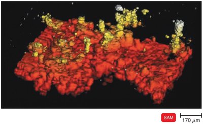 Scanning acoustic microscopy of a bacterial biofilm