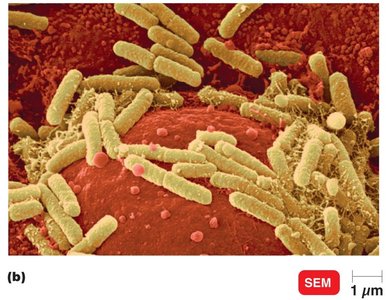 E. coli bacteria adhering to human urinary bladder cells (SEM)