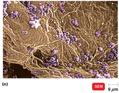 Bacteria adhering to human skin (SEM)