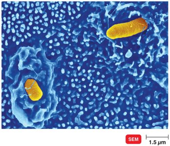 Salmonella entering intestinal epithelial cells via ruffling
