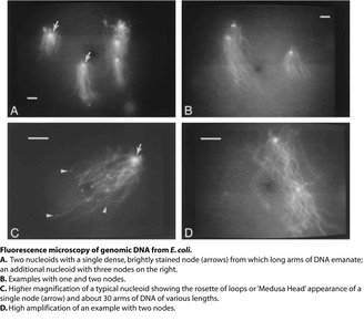 Fluorescence microscopy of E. coli nucleoid