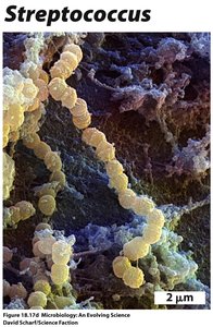Streptococcus cells