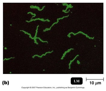 Fluorescent-labeled bacteria under microscope