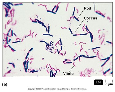Gram-stained bacteria under microscope