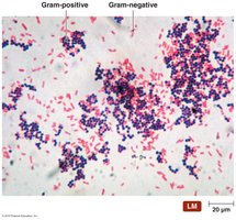 Gram stain results: Gram-positive and Gram-negative bacteria