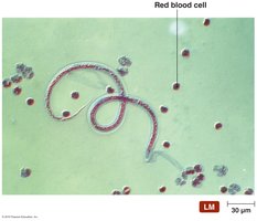 Parasitic worm in blood