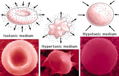 Osmotic effects on cells