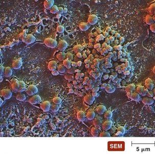 SEM image of biofilm structure
