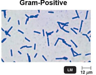 Gram-positive bacteria (purple)