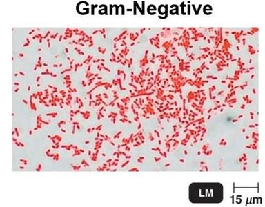 Gram-negative bacteria (red)