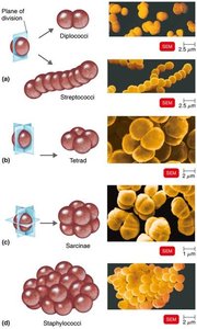Arrangements of cocci: diplococci, streptococci, tetrads, sarcinae, staphylococci