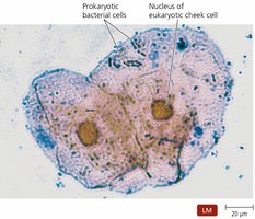 Prokaryotic and eukaryotic cells under microscope