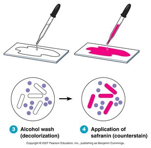 Gram-stained bacteria
