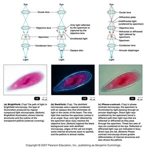 Brightfield, darkfield, and phase-contrast microscopy