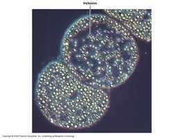 Inclusions in prokaryotic cells
