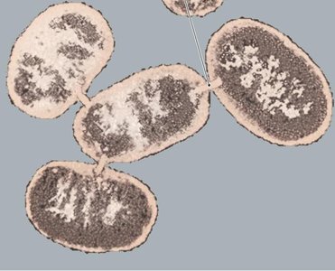 Fimbriae and capsule on bacterial cell