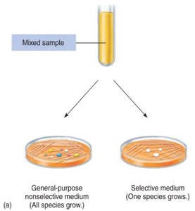 Diagram comparing general-purpose nonselective medium and selective medium