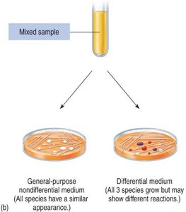 Diagram comparing general-purpose nondifferential medium and differential medium
