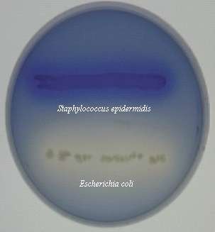 Lipid hydrolysis by lipase