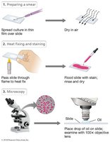 Steps of simple staining procedure