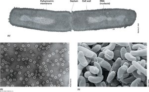 Electron micrographs of bacterial cells