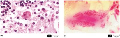 Cytopathic effects of viruses in tissue samples