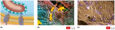 Diagram and micrographs showing bacterial adherence to host cells