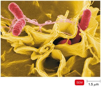 SEM of Salmonella entering intestinal epithelial cells via membrane ruffling