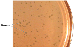 Bacteriophage plaques on agar plate