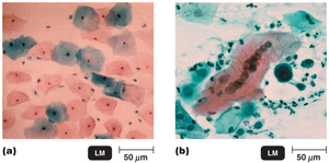 Cytopathic effects in cell cultures