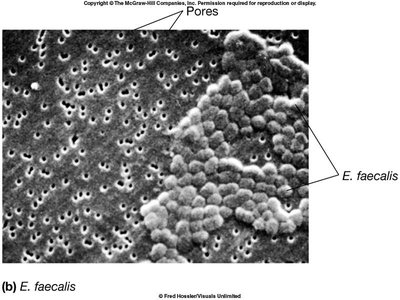 HEPA filter in a biosafety cabinet
